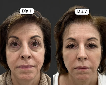 Cepillo para masajes de Drenaje Linfático